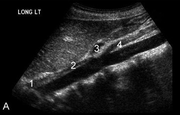 ultrasound [Nick's Radiology Wiki]